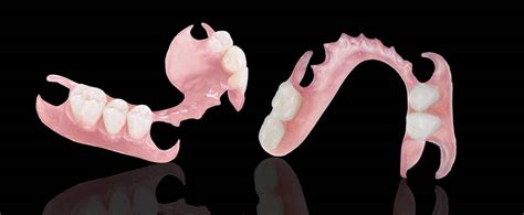 Image result for Different Types Dentures