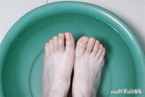 警惕：脚气千万别用45°c以上的水烫脚！皮肤科专家告诉你为什么！ - 知乎