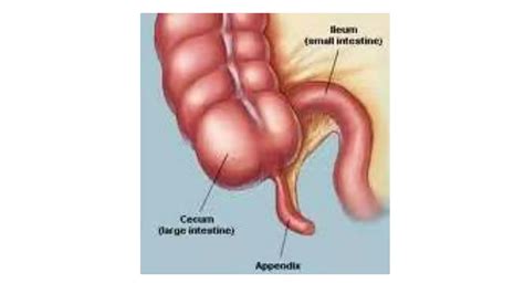 Image result for Understanding the Appendix