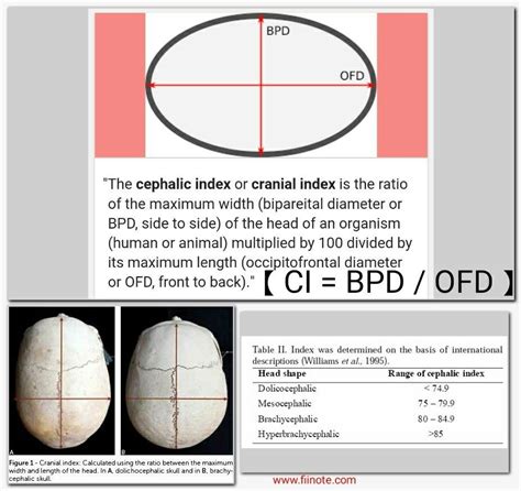 Image result for Identity Conditional or Inconsistent Examples
