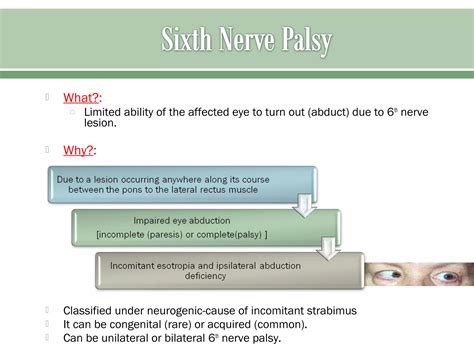 Sixth nerve palsy | PPT