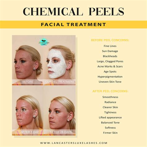 Professional Chemical Peels Lancaster PA | Renew, Brighten & Smooth Skin — Lancaster’s Luxe ...