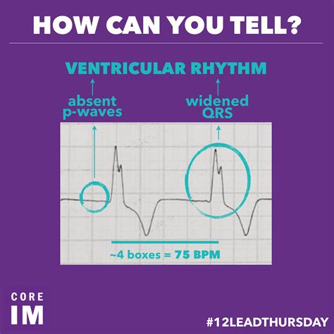 What Does Rabbit Ears Mean On An Ecg at Tonya Barnes blog