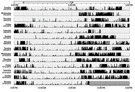 Narcolepsy Sleep Cycle Graph 的图像结果
