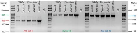 Further Insights into the Ciliary Gene and Protein KIZ and Its Murine ...