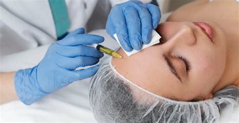 Image result for Common Botox Injections for Men Tutorial