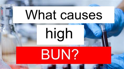 What causes high BUN and low TSH 3? - bun levels low symptoms