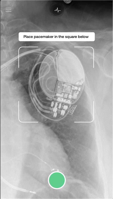 Image result for Frequency Matching Biomedical Device