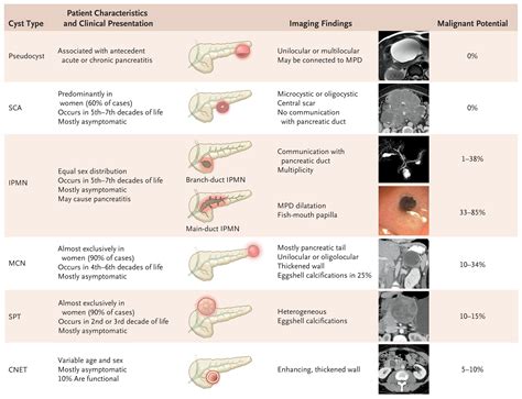 Pancreatic Cysts | New England Journal of Medicine