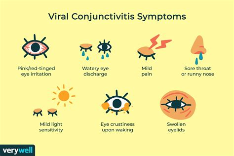 Viral Conjunctivitis: Overview and More