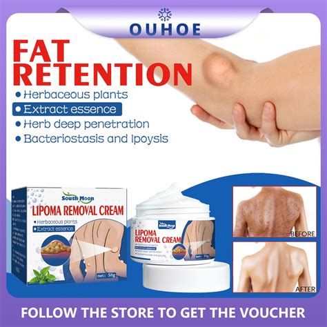 【BUY 2 GET 1】50G Lipoma Removal Cream Lipolysis Fat Lump Relief Plaster Anti-Tumor Skin Swelling ...