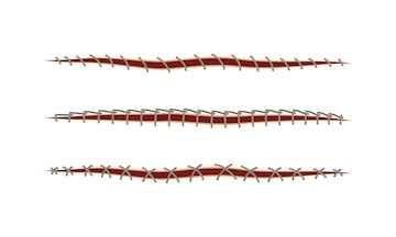 Baseball stitches and red lace with loop of thread isolated on white ...