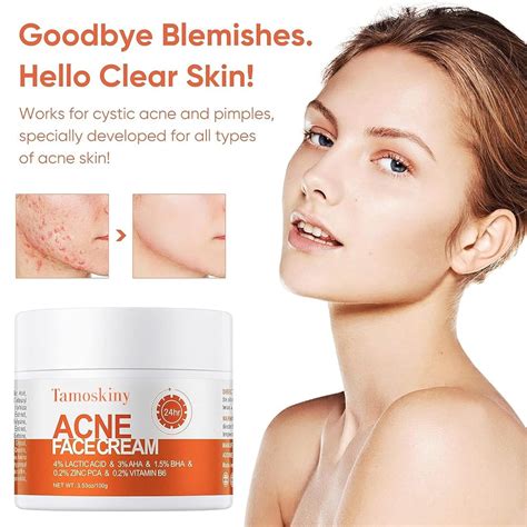 Tamoskiny Salicylic Acid Cystic Acne Treatment - Face & Body India | Ubuy