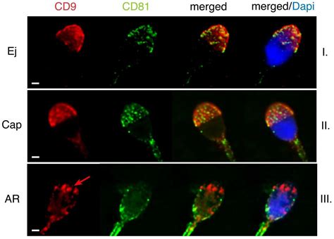 CD9 and CD81 Interactions and Their Structural Modelling in Sperm Prior ...