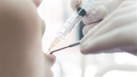 Anesthetics 的图像结果