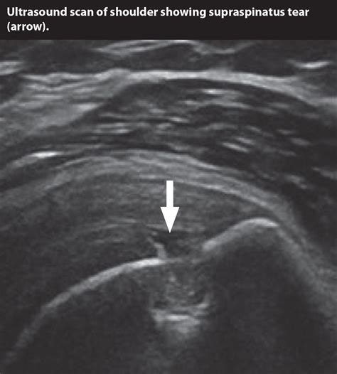 Msk ultrasound – Artofit