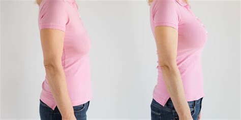 How Long Can A Vampire Breast Lift Last? - Glow Laser Beauty