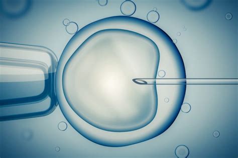 IVF Procedure Explained 的图像结果