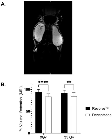 Preclinical Volume Retention of Fat Grafts Processed with REVOLVE ...