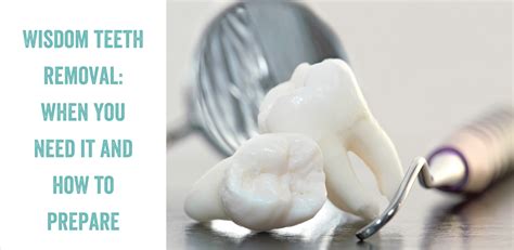 Extracted Wisdom Tooth 的图像结果