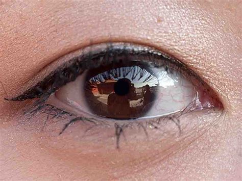 得了红眼病怎么办才好 红眼病的预防方法都有哪些-红眼病预防-复禾健康