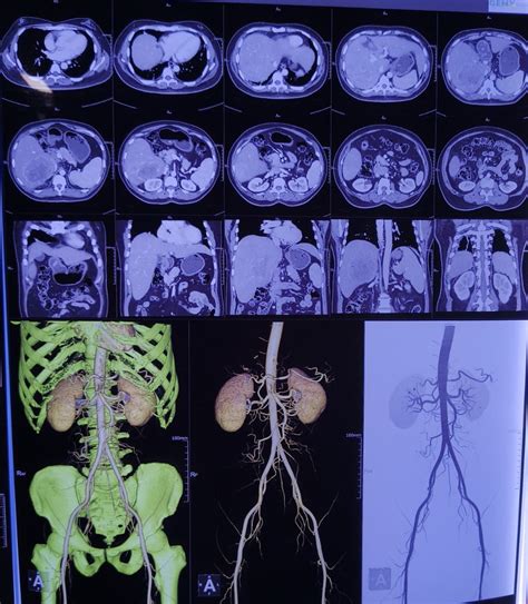 MFilms - HD Color Prints of MRI and CT