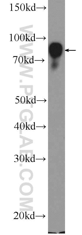 BCL6 antibody (21187-1-AP) | Proteintech