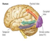 Image result for Visual Spatial Deficits