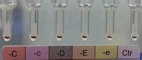 江苏发现2例罕见黄金血型，全球不足50例_阴性_新闻网_Rhc