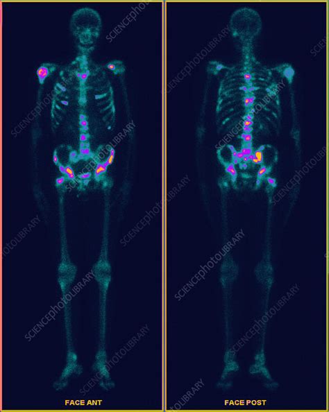 Image result for Open Pet Scan