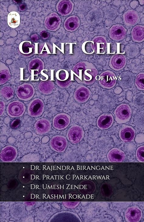 Buy GIANT CELL LESIONS OF JAWS Book Online at Low Prices in India ...