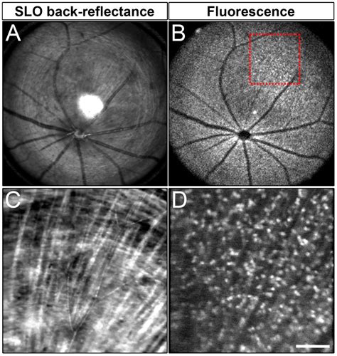 A Novel Reporter Mouse Uncovers Endogenous Brn3b Expression