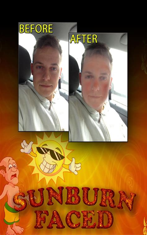 Sunburn Face FX Photo Booth Free - App on Amazon Appstore