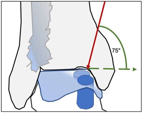 Diagnostics | An Open Access Journal from MDPI