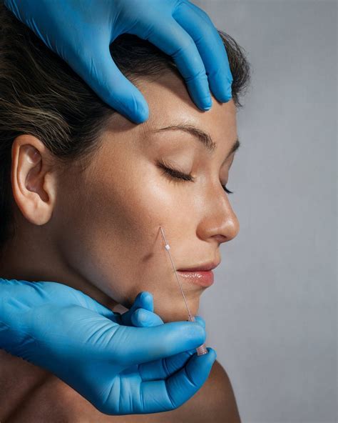 Image result for Cheek Threads