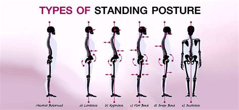 Different Types of Posture 的图像结果