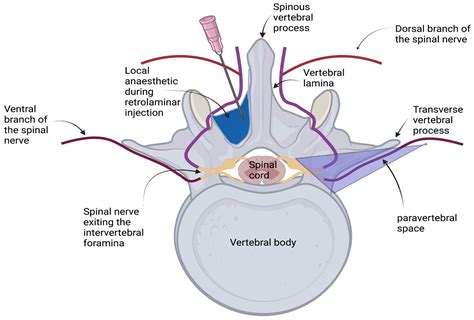 Intercostal Nerve Block Canine