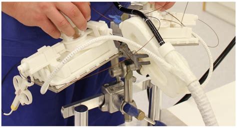 The Role of Specialized Instruments for Advanced Endoscopic Resections ...
