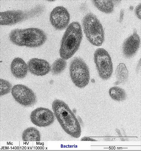 Advanced Centre for Treatment Research & Education in Cancer | Electron ...