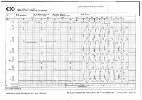SARS-CoV-2 Infection and Emery-Dreifuss Syndrome in a Young Patient ...