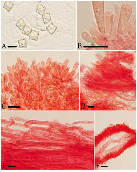 Seven New Species of Entoloma Subgenus Cubospora (Entolomataceae ...