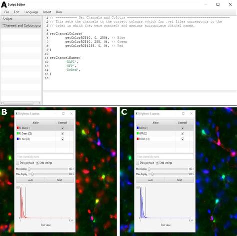 Image result for QuPath Basics