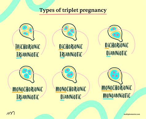 Types of Twin and Triplet Pregnancies