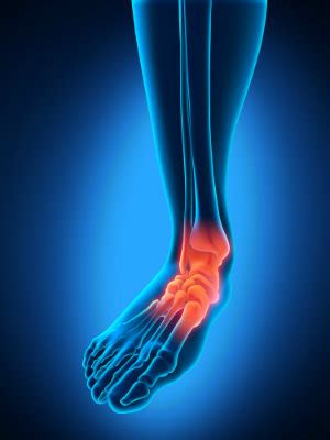 Causes of Ankle Pain | Absolute Foot Care Specialists