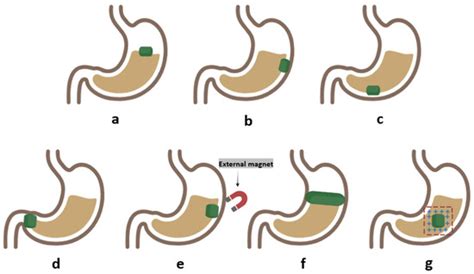 Expanding the Manufacturing Approaches for Gastroretentive Drug ...