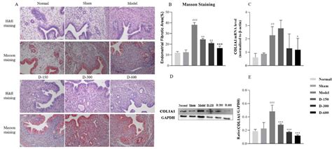 Dulaglutide Ameliorates Intrauterine Adhesion by Suppressing ...