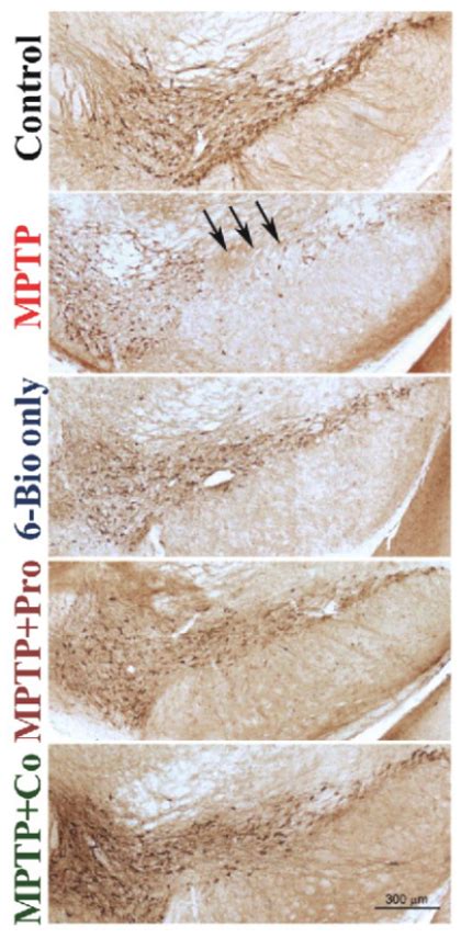 Neurodegeneration and Autophagy | Official website of Jawaharlal Nehru ...