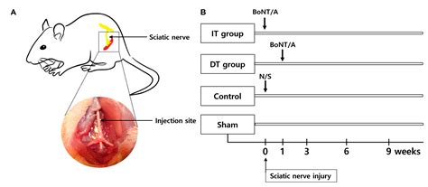 Comparison of Neural Recovery Effects of Botulinum Toxin Based on ...