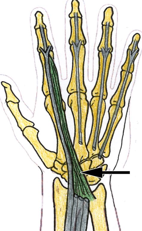 Image result for Running Extensor Tendonitis