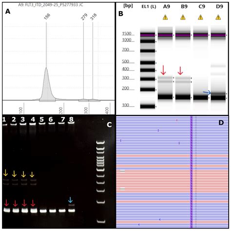 A Modified FLT3 PCR Assay Using a TapeStation Readout